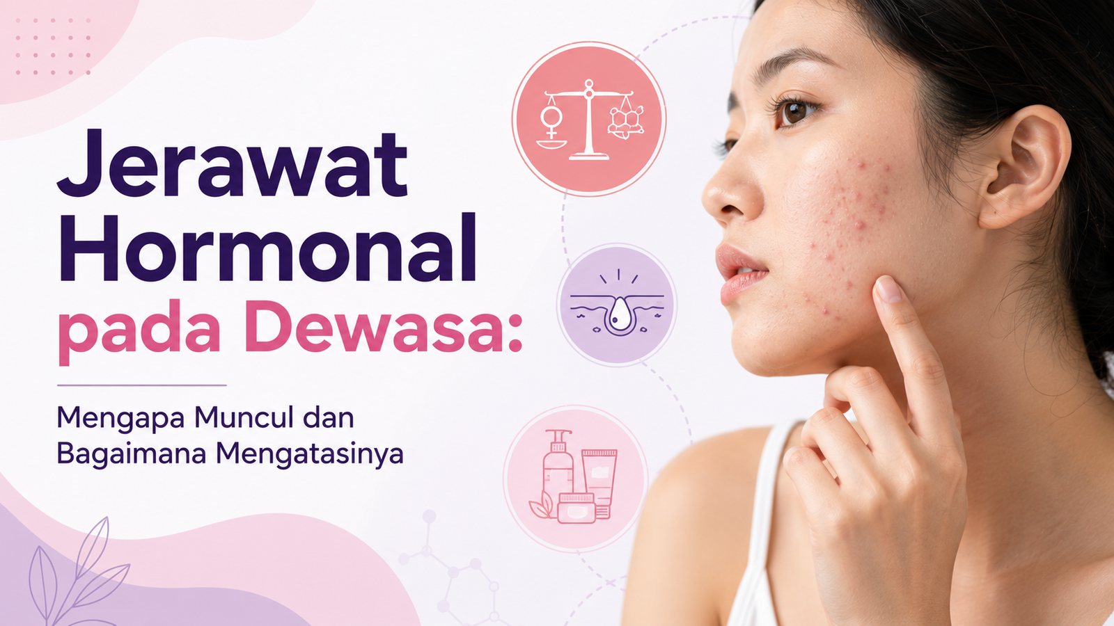 Jerawat Hormonal pada Dewasa: Mengapa Muncul dan Bagaimana Mengatasinya