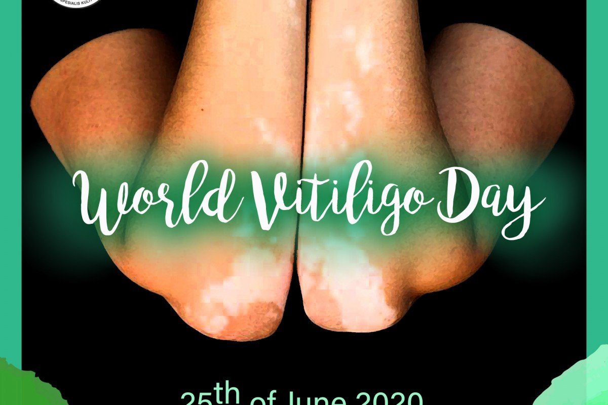 World Vitiligo Day