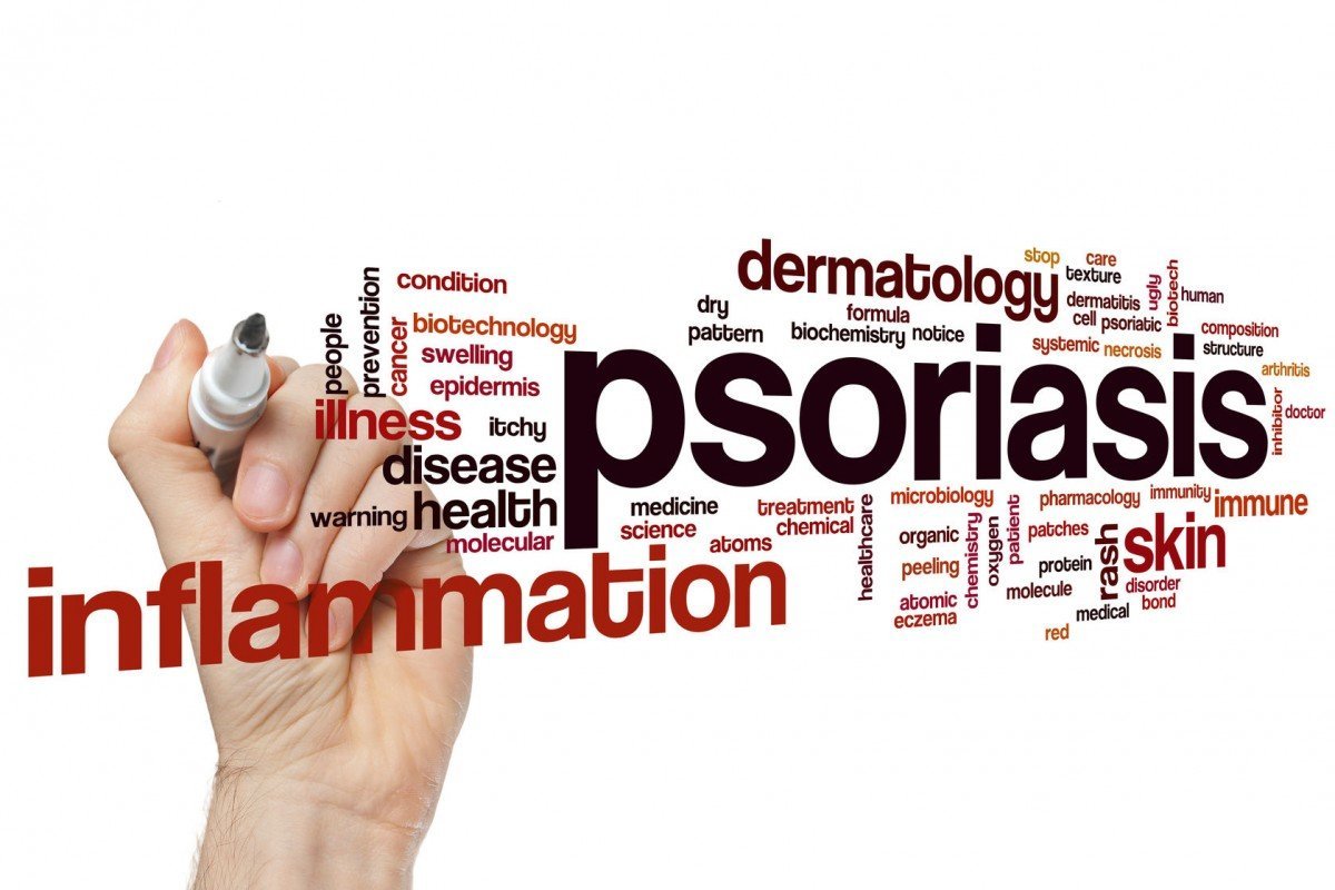 Psoriasis. Tidak Dapat Disembuhkan, Tapi Bisa Dikendalikan