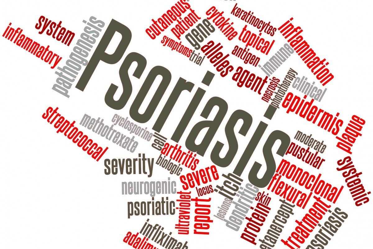 Psoriasis Bisa Tingkatkan Risiko Serangan Jantung, Diabetes, Obesitas dan Penyakit Lainnya