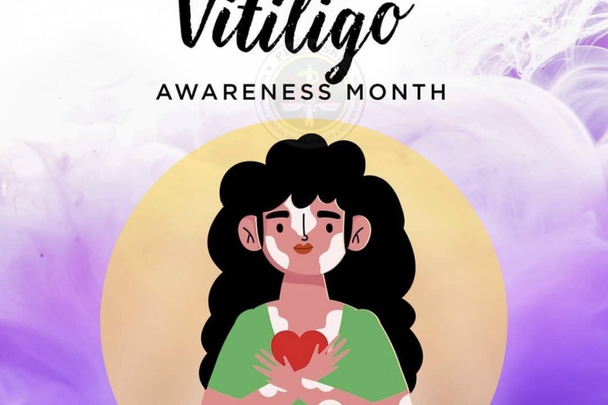 Vitiligo Awareness Month