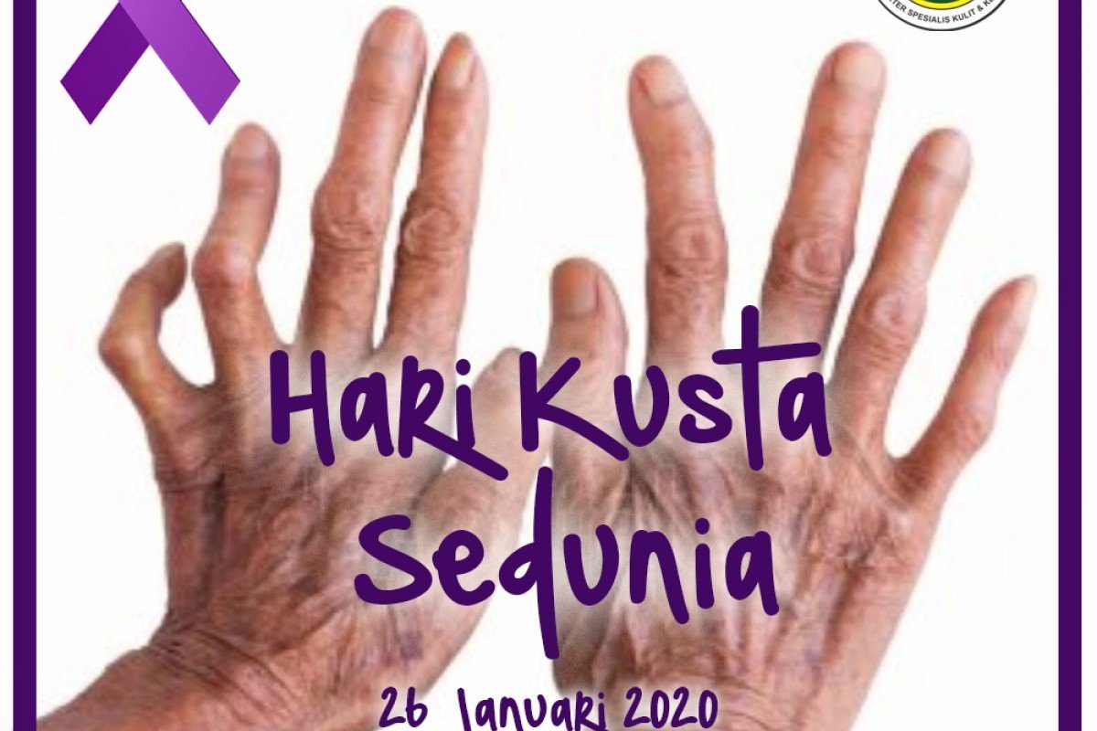 Hari Kusta Sedunia ke-67